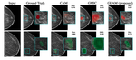 Weakly-supervised High-resolution Segmentation of Mammography Images for Breast Cancer Diagnosis