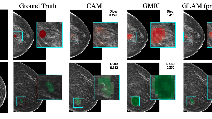 Weakly-supervised High-resolution Segmentation of Mammography Images for Breast Cancer Diagnosis